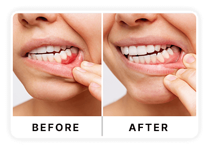 DentaVive supplement customer reviews